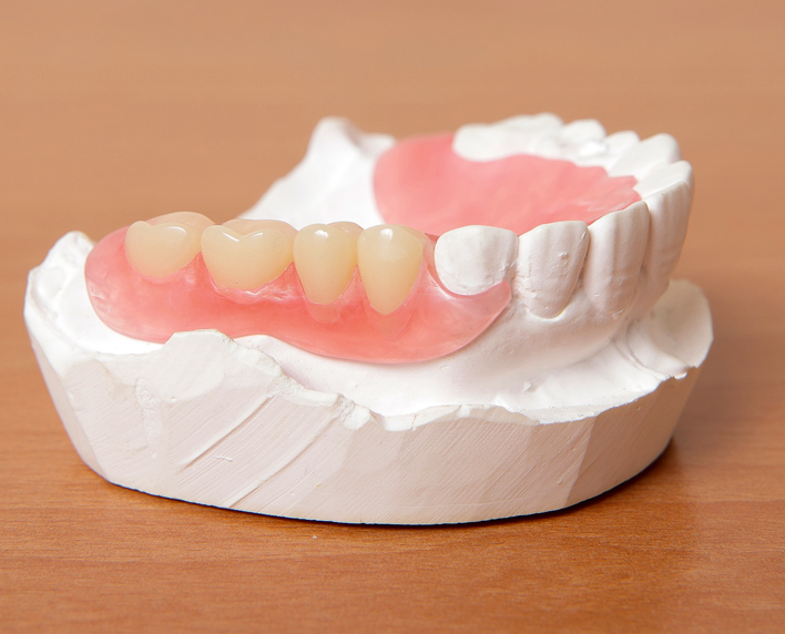 prótesis dental removible